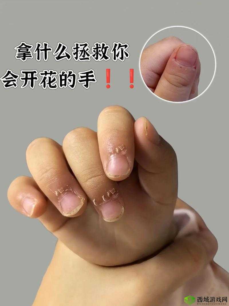 宝宝:才三根手指,就这么疼