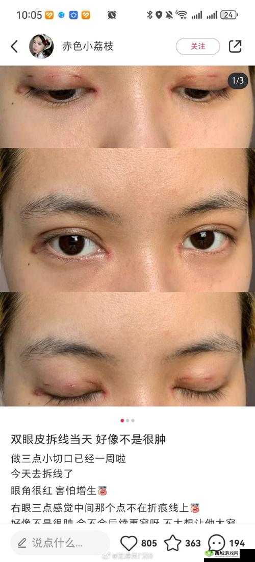 女生开过包以后会有什么样的变化:深度剖析